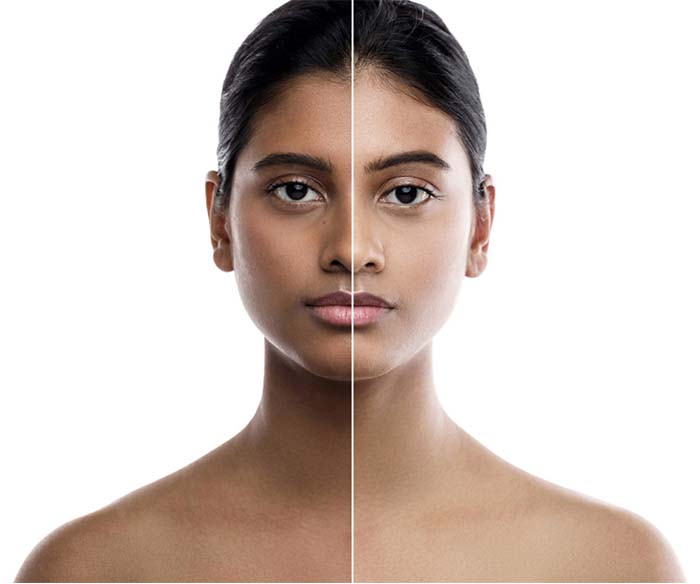 Body Tone & Pigmentation Treatment in Thane